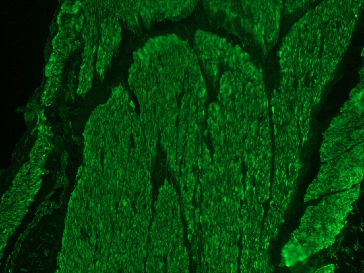 Figure 2. Muscle cell immunostaining in frozen section of chicken gizzard for desmin using MUB0402S (K5; diluted 1:200)